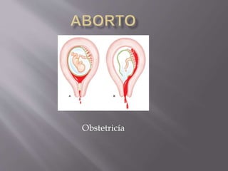 Obstetricía
 