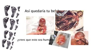 Así quedaría tu bebé
¿crees que esto sea humano?
 