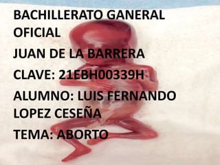 BACHILLERATO GANERAL
OFICIAL
JUAN DE LA BARRERA
CLAVE: 21EBH00339H
ALUMNO: LUIS FERNANDO
LOPEZ CESEÑA
TEMA: ABORTO
 