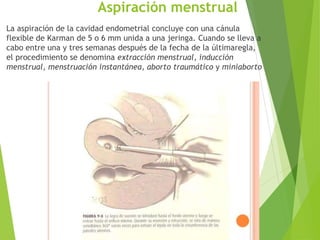 Aspiración menstrual
La aspiración de la cavidad endometrial concluye con una cánula
flexible de Karman de 5 o 6 mm unida a una jeringa. Cuando se lleva a
cabo entre una y tres semanas después de la fecha de la últimaregla,
el procedimiento se denomina extracción menstrual, inducción
menstrual, menstruación instantánea, aborto traumático y miniaborto
 