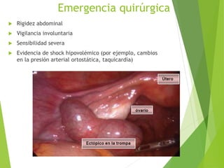 Emergencia quirúrgica
 Rigidez abdominal
 Vigilancia involuntaria
 Sensibilidad severa
 Evidencia de shock hipovolémico (por ejemplo, cambios
en la presión arterial ortostática, taquicardia)
 