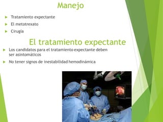 Manejo
 Tratamiento expectante
 El metotrexato
 Cirugía
 