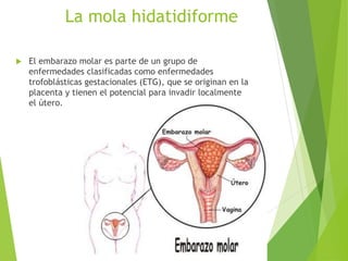 La mola hidatidiforme
 El embarazo molar es parte de un grupo de
enfermedades clasificadas como enfermedades
trofoblásticas gestacionales (ETG), que se originan en la
placenta y tienen el potencial para invadir localmente
el útero.
 