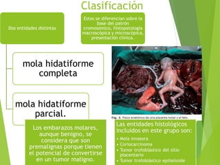 Clasificación
Dos entidades distintas
mola hidatiforme
completa
mola hidatiforme
parcial.
Estos se diferencian sobre la
base del patrón
cromosómico, histopatología
macroscópica y microscópica,
presentación clínica.
 