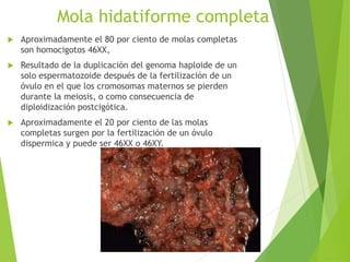 Mola hidatiforme completa
 Aproximadamente el 80 por ciento de molas completas
son homocigotos 46XX,
 Resultado de la duplicación del genoma haploide de un
solo espermatozoide después de la fertilización de un
óvulo en el que los cromosomas maternos se pierden
durante la meiosis, o como consecuencia de
diploidización postcigótica.
 Aproximadamente el 20 por ciento de las molas
completas surgen por la fertilización de un óvulo
dispermica y puede ser 46XX o 46XY.
 