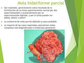 Mola hidatiforme parcial
 Son triploides, generalmente como resultado de la
fertilización de un óvulo aparentemente normal por dos
espermatozoides u ocasionalmente por un
espermatozoide diploide, y por lo tanto pueden ser
69XXX, 69XXY, o 69XYY
 La existencia de mola parcial diploide es poco probable
 La mayoría de los casos reportados representan molas
completas mal diagnosticados o embarazos gemelares.
 