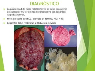 DIAGNÓSTICO
 La posibilidad de mola hidatidiforme se debe considerar
en cualquier mujer en edad reproductiva con sangrado
vaginal anormal.
 Nivel en suero de (hCG) elevada (> 100 000 mUI / ml)
 Ecografía debe realizarse si HCG está elevada
 