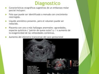 Diagnostico
 Características ecográficas sugestivas de un embarazo molar
parcial incluyen:
 Feto que puede ser identificado a menudo con crecimiento
restringido.
 Líquido amniótico presente, pero el volumen puede ser
reducido.
 Placenta con uno o más hallazgos anormales: agrandados,
espacios quísticos ( "patrón de queso suizo") y / o aumento de
la ecogenicidad de las vellosidades coriónicas.
 Aumento del diámetro transversal del saco gestacional
 
