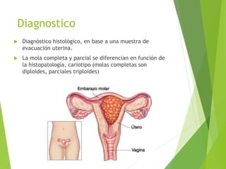 Diagnostico
 Diagnóstico histológico, en base a una muestra de
evacuación uterina.
 La mola completa y parcial se diferencian en función de
la histopatología, cariotipo (molas completas son
diploides, parciales triploides)
 