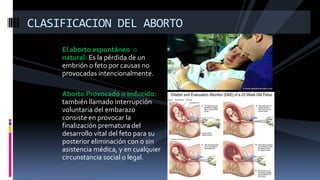 El aborto espontáneo o
natural: Es la pérdida de un
embrión o feto por causas no
provocadas intencionalmente.
Aborto Provocado o Inducido:
también llamado interrupción
voluntaria del embarazo
consiste en provocar la
finalización prematura del
desarrollo vital del feto para su
posterior eliminación con o sin
asistencia médica, y en cualquier
circunstancia social o legal.
CLASIFICACION DEL ABORTO
 