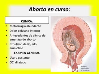 Aborto en curso:
CLINICA:
• Metrorragia abundante
• Dolor pelviano intenso
• Antecedentes de clínica de
amenaza de aborto
• Expulsión de líquido
amniótico
EXAMEN GENERAL
• Útero gestante
• OCI dilatado
 