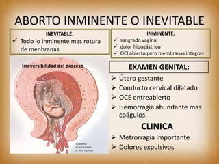 ABORTO INMINENTE O INEVITABLE
EXAMEN GENITAL:
 Útero gestante
 Conducto cervical dilatado
 OCE entreabierto
 Hemorragia abundante mas
coágulos.
CLINICA
 Metrorragia importante
 Dolores expulsivos
Irreversibilidad del proceso
INMINENTE:
 sangrado vaginal
 dolor hipogástrico
 OCI abierto pero membranas integras
INEVITABLE:
 Todo lo inminente mas rotura
de menbranas
 
