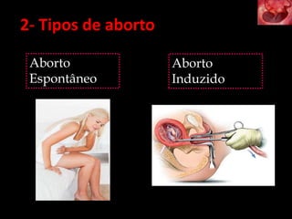 Aborto
Espontâneo
Aborto
Induzido
2- Tipos de aborto
 