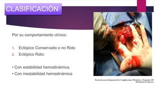 Por su comportamiento clínico:
1. Ectópico Conservado o no Roto
2. Ectópico Roto:
• Con estabilidad hemodinámica.
• Con inestabilidad hemodinámica
CLASIFICACIÓN
 