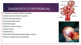 DIAGNÓSTICO DIFERENCIAL
 Amenaza de aborto o aborto incompleto.
• Quistes de ovario (torsión o ruptura).
• Ruptura del quiste folicular
• Hemorragia disfuncional.
• Apendicitis aguda.
• Infección de vías urinarias.
• Torsión anexial.
• Endometrioma.
• Enfermedad inflamatoria pélvica aguda o crónica.
• Mioma en degeneración de embarazo
 