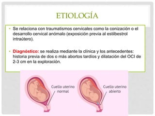 ETIOLOGÍA
• Se relaciona con traumatismos cervicales como la conización o el
desarrollo cervical anómalo (exposición previa al estilbestrol
intraútero).
• Diagnóstico: se realiza mediante la clínica y los antecedentes:
historia previa de dos o más abortos tardíos y dilatación del OCI de
2-3 cm en la exploración.
 