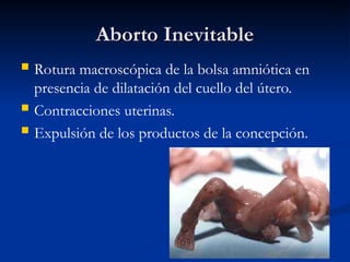 Aborto Inevitable
Aborto Inevitable
 Rotura macroscópica de la bolsa amniótica en
presencia de dilatación del cuello del útero.
 Contracciones uterinas.
 Expulsión de los productos de la concepción.
 