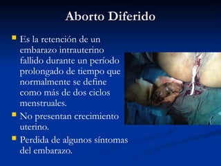 Aborto Diferido
Aborto Diferido
 Es la retención de un
embarazo intrauterino
fallido durante un período
prolongado de tiempo que
normalmente se define
como más de dos ciclos
menstruales.
 No presentan crecimiento
uterino.
 Perdida de algunos síntomas
del embarazo.
 