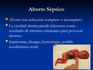 Aborto Séptico
Aborto Séptico
 Aborto con infección completo o incompleto.
 La cavidad uterina puede infectarse como
resultado de intentos criminales para provocar
abortos.
 Septicemia, choque, hemorragia, posible
insuficiencia renal.
 