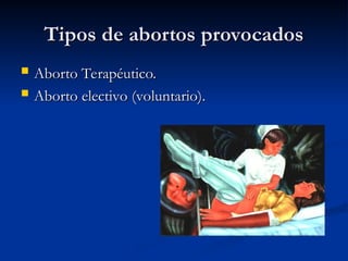 Tipos de abortos provocados
Tipos de abortos provocados
 Aborto Terapéutico.
Aborto Terapéutico.
 Aborto
Aborto electivo (voluntario).
electivo (voluntario).
 