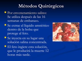Métodos Quirúrgicos
Métodos Quirúrgicos
 Por envenenamiento salino:
Por envenenamiento salino:
Se utiliza después de las 16
semanas de embarazo.
 Se extrae el líquido amniótico
dentro de la bolsa que
protege al feto.
 Se inyecta en su lugar una
solución salina concentrada.
 El feto ingiere esta solución,
que le producirá la muerte 12
horas más tarde.
 