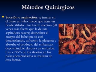 Métodos Quirúrgicos
Métodos Quirúrgicos
 Succión o aspiración
Succión o aspiración:
: se inserta en
el útero un tubo hueco que tiene un
borde afilado. Una fuerte succión (28
veces más fuerte que la de una
aspiradora casera) despedaza el
cuerpo del bebé que se está
desarrollando, así como la placenta y
absorbe el producto del embarazo,
depositándolo después en un balde.
Casi el 95% de los abortos en los
países desarrollados se realizan de
esta forma.
 