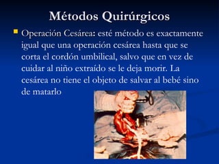 Métodos Quirúrgicos
Métodos Quirúrgicos
 Operación Cesárea
Operación Cesárea:
: esté método es exactamente
igual que una operación cesárea hasta que se
corta el cordón umbilical, salvo que en vez de
cuidar al niño extraído se le deja morir. La
cesárea no tiene el objeto de salvar al bebé sino
de matarlo
 