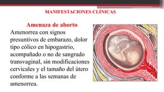 MANIFESTACIONES CLÍNICAS
Amenaza de aborto
Amenorrea con signos
presuntivos de embarazo, dolor
tipo cólico en hipogastrio,
acompañado o no de sangrado
transvaginal, sin modificaciones
cervicales y el tamaño del útero
conforme a las semanas de
amenorrea.
 