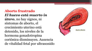 Aborto frustrado
El huevo está muerto in
útero, no hay signos, ni
síntomas de aborto, el
crecimiento uterino está
detenido, los niveles de la
hormona gonadotropina
coriónica disminuyen. Ausencia
de vitalidad fetal por ultrasonido
 