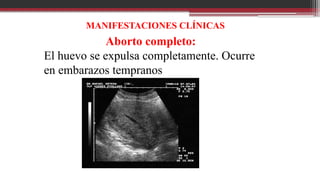 MANIFESTACIONES CLÍNICAS
Aborto completo:
El huevo se expulsa completamente. Ocurre
en embarazos tempranos
 