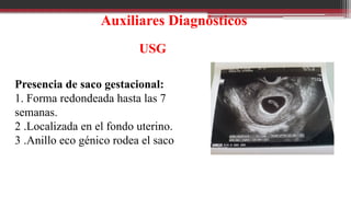 Auxiliares Diagnósticos
USG
Presencia de saco gestacional:
1. Forma redondeada hasta las 7
semanas.
2 .Localizada en el fondo uterino.
3 .Anillo eco génico rodea el saco
 