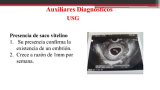 Auxiliares Diagnósticos
USG
Presencia de saco vitelino
1. Su presencia confirma la
existencia de un embrión.
2. Crece a razón de 1mm por
semana.
 