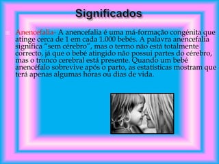 

Anencefalia- A anencefalia é uma má-formação congénita que
atinge cerca de 1 em cada 1.000 bebés. A palavra anencefalia
significa “sem cérebro”, mas o termo não está totalmente
correcto, já que o bebé atingido não possui partes do cérebro,
mas o tronco cerebral está presente. Quando um bebé
anencéfalo sobrevive após o parto, as estatísticas mostram que
terá apenas algumas horas ou dias de vida.

 