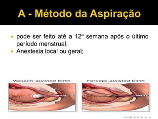 pode ser feito até a 12ª semana após o último
período menstrual;
 Anestesia local ou geral;


 