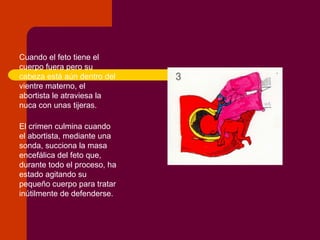 Cuando el feto tiene el
cuerpo fuera pero su
cabeza está aún dentro del
vientre materno, el
abortista le atraviesa la
nuca con unas tijeras.
El crimen culmina cuando
el abortista, mediante una
sonda, succiona la masa
encefálica del feto que,
durante todo el proceso, ha
estado agitando su
pequeño cuerpo para tratar
inútilmente de defenderse.
 