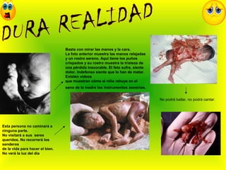 Basta con mirar las manos y la cara.
La foto anterior muestra las manos relajadas
y un rostro sereno. Aquí tiene los puños
crispados y su rostro muestra la tristeza de
una pérdida inexorable. El feto sufre, siente
dolor. Indefenso siente que lo han de matar.
Existen videos
que muestran cómo el niño rehuye en el
seno de la madre los instrumentos asesinos.
No podrá bailar, no podrá cantar.
Esta persona no caminará a
ninguna parte.
No visitará a sus seres
queridos. No recorrerá los
senderos
de la vida para hacer el bien.
No verá la luz del día
 