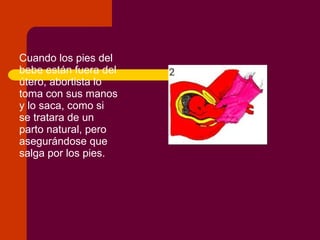 Aborto diapositivas-