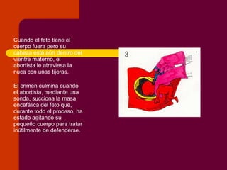 Aborto diapositivas-