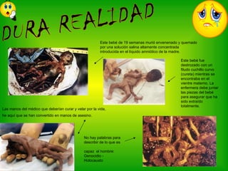 Aborto diapositivas-