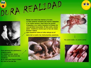 Aborto diapositivas-