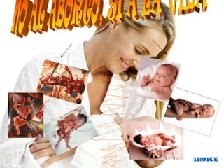 Aborto diapositivas-