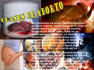 Aborto diapositivas-