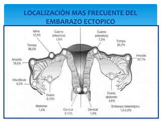 LOCALIZACIÒN MAS FRECUENTE DEL EMBARAZO ECTOPICO 