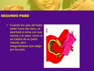 SEGUNDO PASO
ü Cuando los pies del bebé
están fuera del útero, el
abortista lo toma con sus
manos y lo saca, como si
se tratara de un parto
natural, pero
asegurándose que salga
por los pies.
 