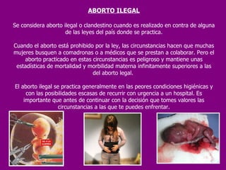 ABORTO ILEGAL Se considera aborto ilegal o clandestino cuando es realizado en contra de alguna de las leyes del país donde se practica. Cuando el aborto está prohibido por la ley, las circunstancias hacen que muchas mujeres busquen a comadronas o a médicos que se prestan a colaborar. Pero el aborto practicado en estas circunstancias es peligroso y mantiene unas estadísticas de mortalidad y morbilidad materna infinitamente superiores a las del aborto legal.  El aborto ilegal se practica generalmente en las peores condiciones higiénicas y con las posibilidades escasas de recurrir con urgencia a un hospital. Es importante que antes de continuar con la decisión que tomes valores las circunstancias a las que te puedes enfrentar. 
