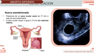 CLASIFICACION
ABORTO DIFERIDO
• Presencia de un saco ovular vacío de 17 mm o
más sin eco embrionario
• O saco ovular mayor o igual a 13 mm sin vesícula
vitelina
Huevo anembrionado
 