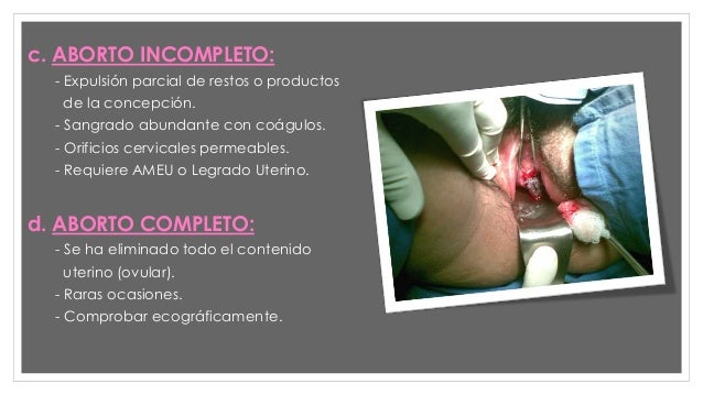 el aborto el aborto