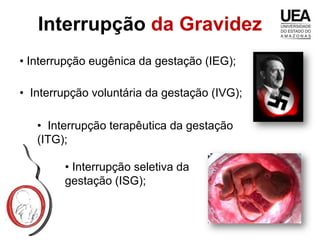 Interrupção da Gravidez
• Interrupção eugênica da gestação (IEG);

• Interrupção voluntária da gestação (IVG);

   • Interrupção terapêutica da gestação
   (ITG);

        • Interrupção seletiva da
        gestação (ISG);
 