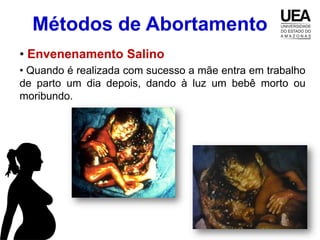Métodos de Abortamento
• Envenenamento Salino
• Quando é realizada com sucesso a mãe entra em trabalho
de parto um dia depois, dando à luz um bebê morto ou
moribundo.
 