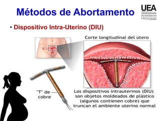 Métodos de Abortamento
• Dispositivo Intra-Uterino (DIU)
 